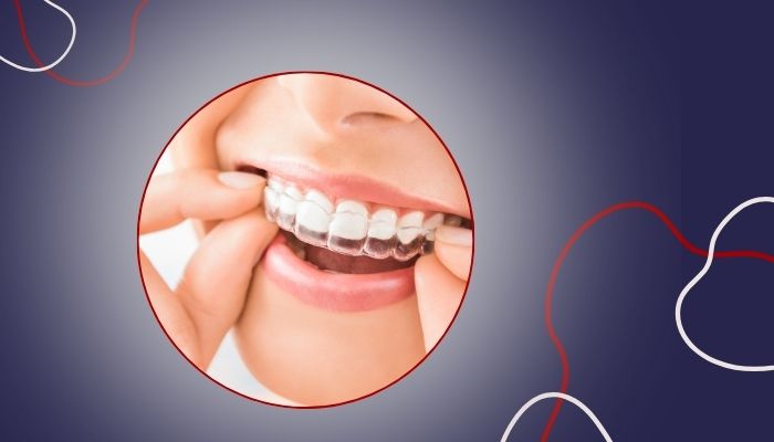ارتودنسی و درمان ناهنجاری‌های دندانی