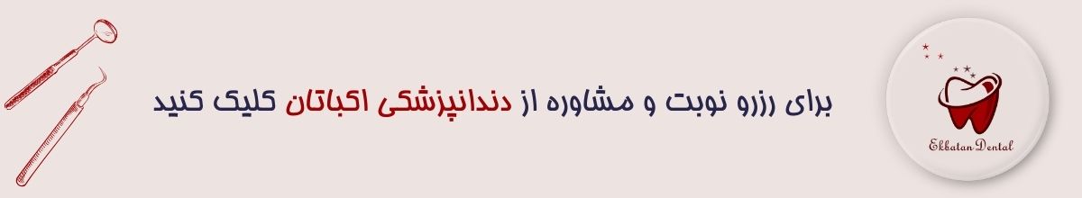 HSG با بیهوشی و یا بدون بیهوشی HSG با بیهوشی و یا بدون بیهوشی