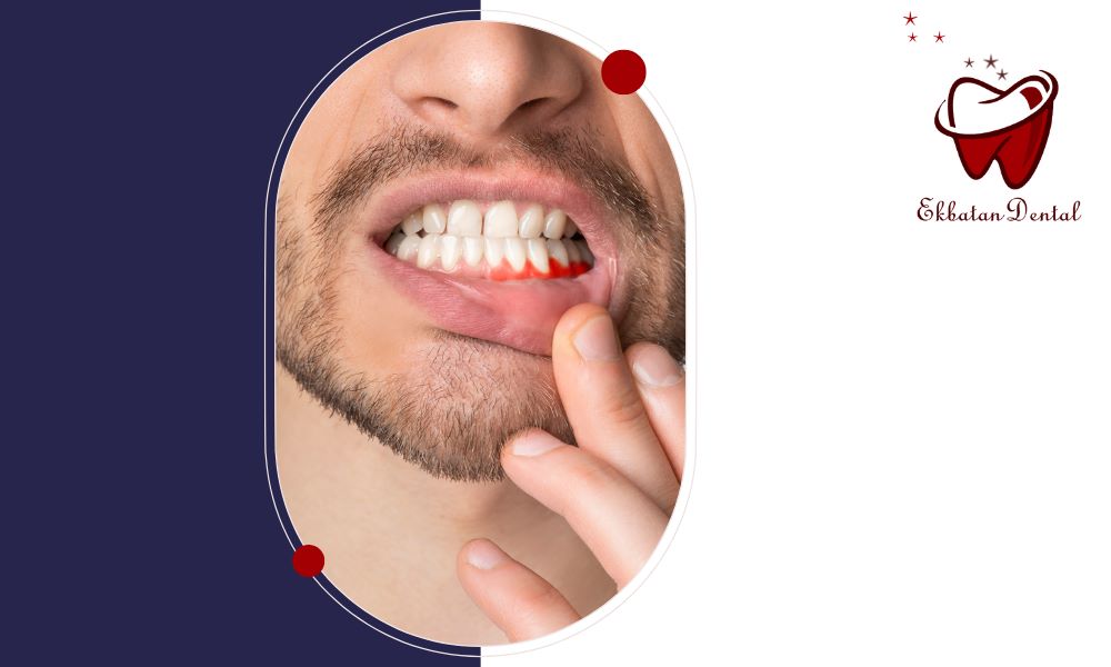 حساس شدن دندان پس از کامپوزیت طبیعی است یا نگران‌کننده؟