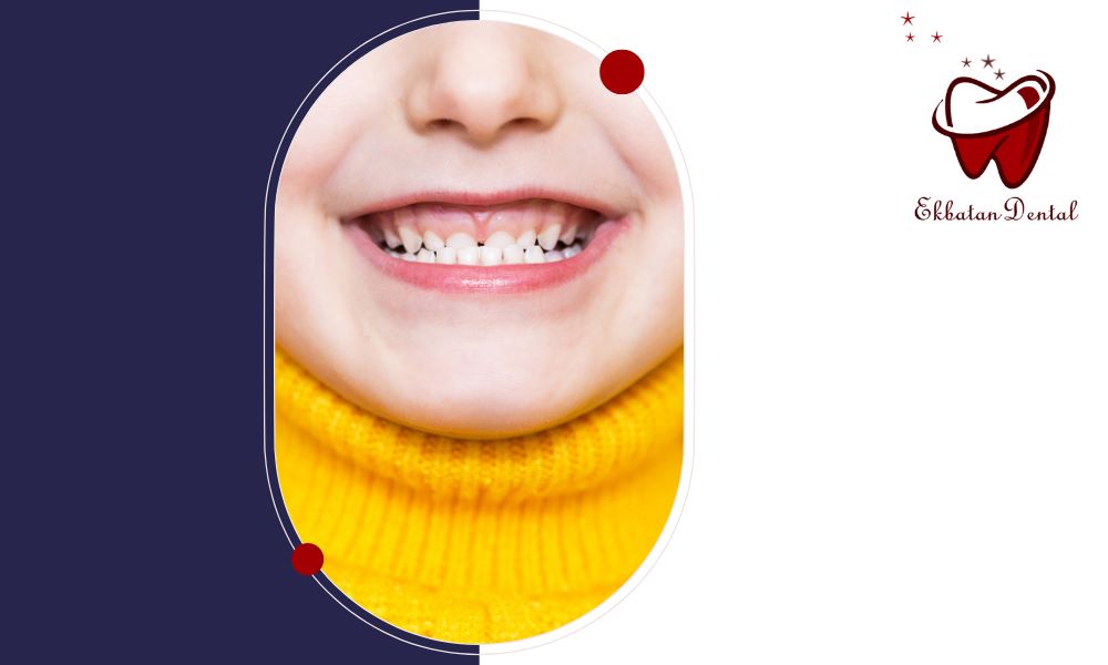 مال اکلوژن و بهترین روش‌های درمان و اصلاح ناهنجاری‌های دندانی