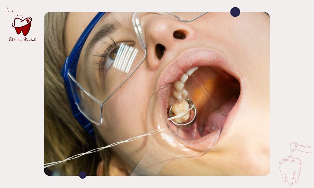 عوامل تاثیرگذار بر هزینه 