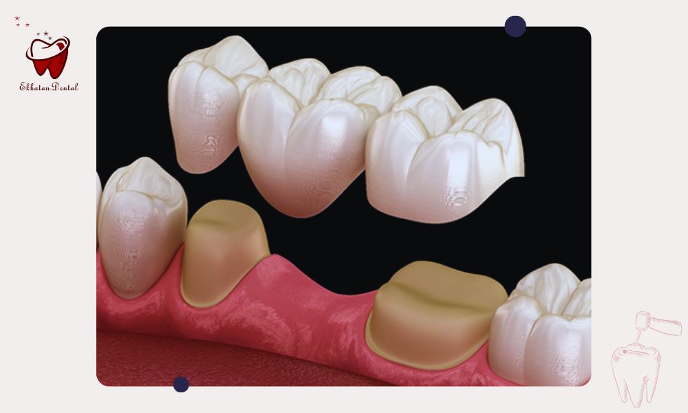 کدام روش ظاهر طبیعی‌تری دارد؟