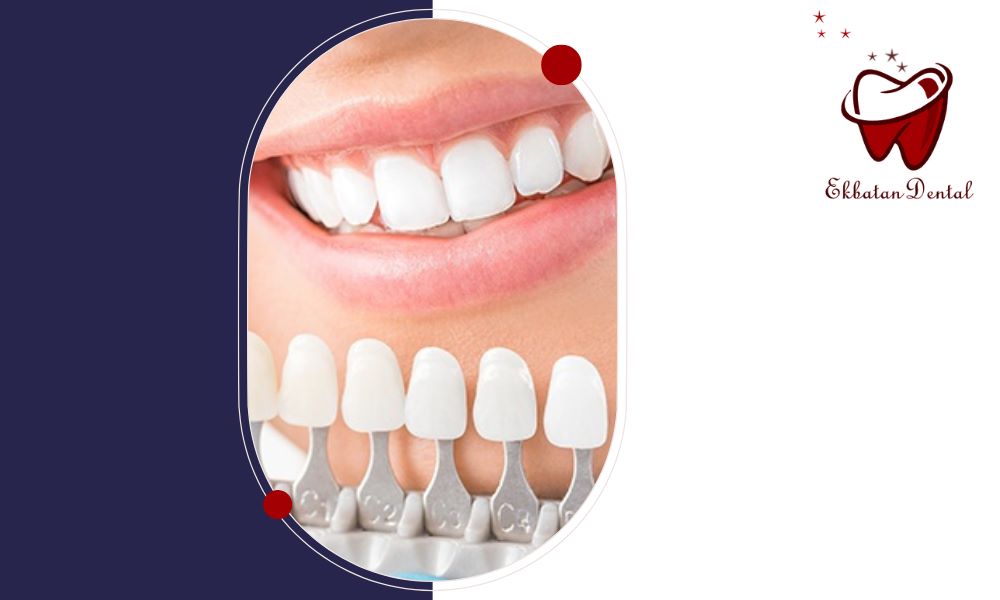 نکات مهم مراقبت های پس از پر کردن دندان برای دوام بیشتر