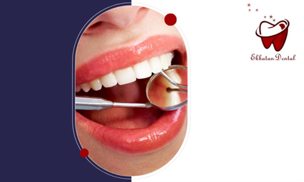 مال اکلوژن و بهترین روش‌های درمان و اصلاح ناهنجاری‌های دندانی